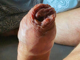 Profile Picture of foreskinplayer
